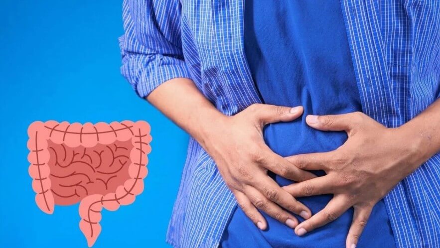 crohn's disease