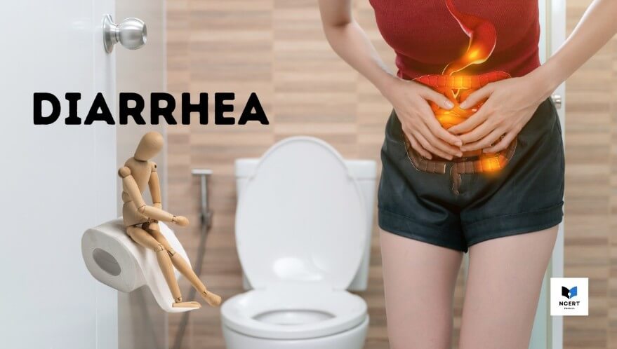 Diarrhea